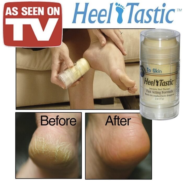 heeltastic intensive heel therapy image
